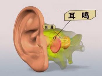耳鸣是怎么回事